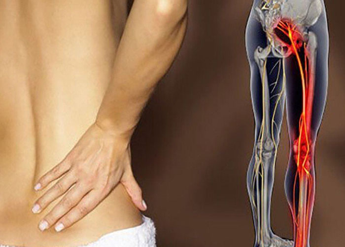 Đai lưng thảo dược có hỗ trợ cải thiện hệ thần kinh không?