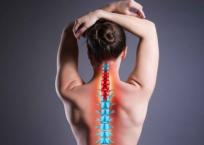 Đai lưng thảo dược có phù hợp với người thoát vị đĩa đệm không?