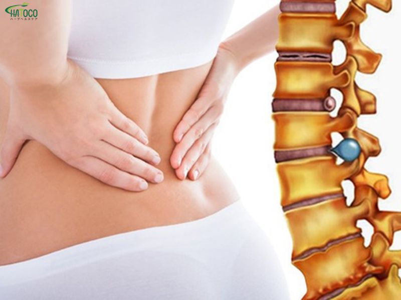 Tìm hiểu đai lưng thảo dược có phù hợp với ngời thoát vị đĩa đệm không