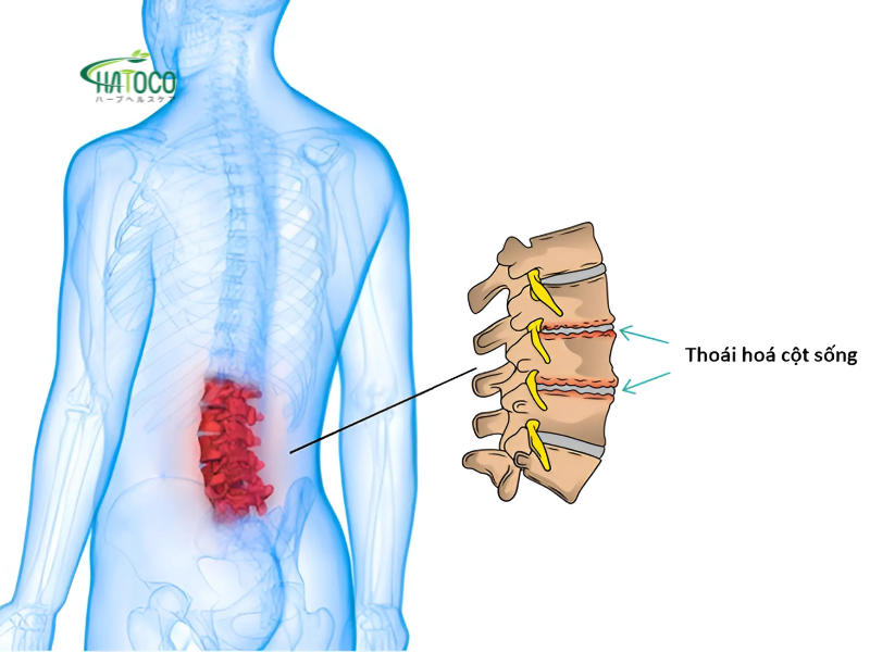 cach-dai-lung-thao-duoc-ho-tro-giam-dau-do-thoai-hoa-cot-song