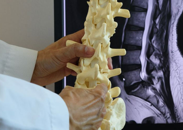 Các mức độ thoái hóa cột sống và cách điều trị