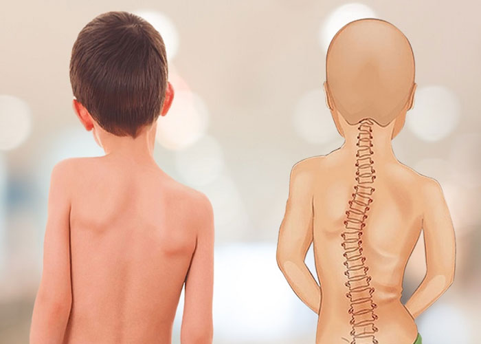 Cách kiểm tra cột sống tại nhà đơn giản, dễ thực hiện