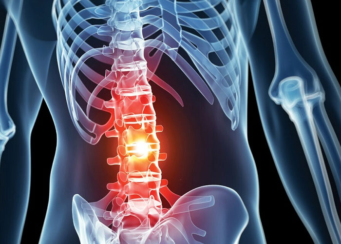 Đối tượng dễ bị thoái hóa cột sống và dấu hiệu nhận biết?