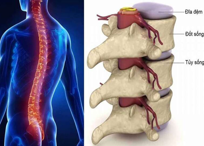 Nguyên nhân gây thoái hóa cột sống