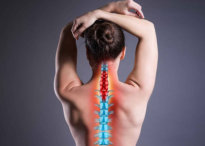 Nguyên nhân thoát vị đĩa đệm là gì? Cách phòng ngừa ra sao?