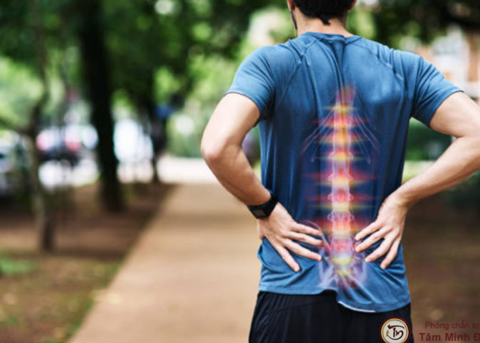 Thoái hóa cột sống ở người trẻ có triệu chứng gì?