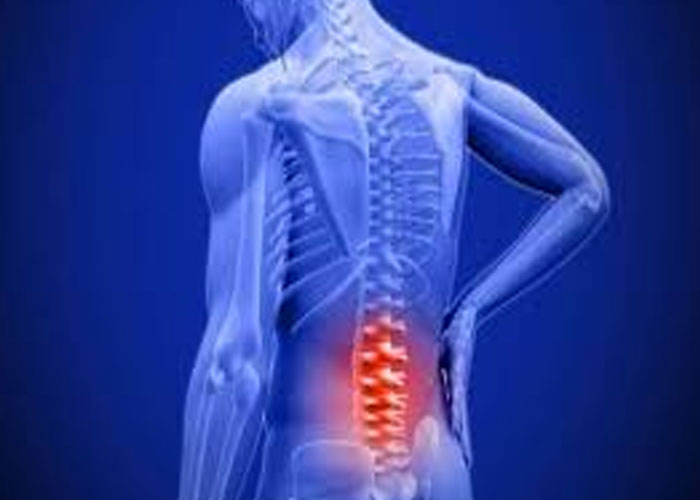 Triệu chứng thoái hóa cột sống thắt lưng là gì? Cách điều trị ra sao?