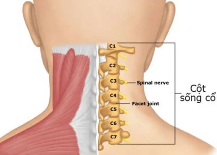 Triệu chứng thoái hóa cổ và cách phòng tránh hiệu quả