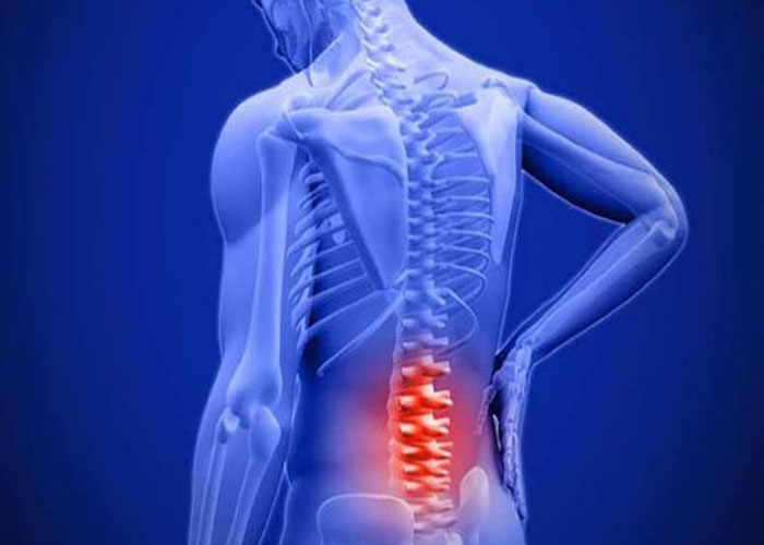 Triệu chứng thoái hóa lưng, ai dễ bị và biện pháp phòng ngừa?