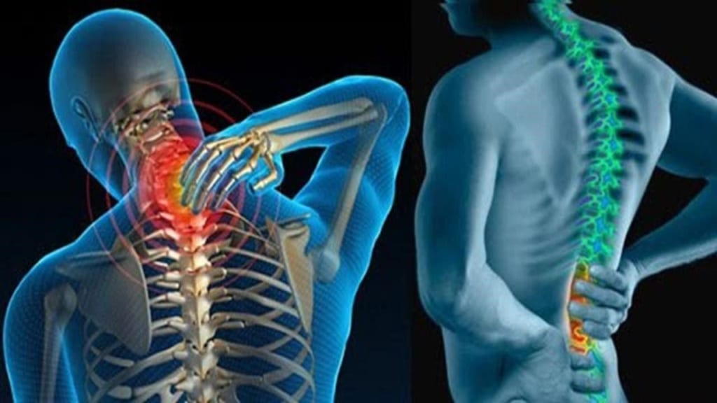 Bị gai cột sống có sao không? Cách điều trị thế nào?