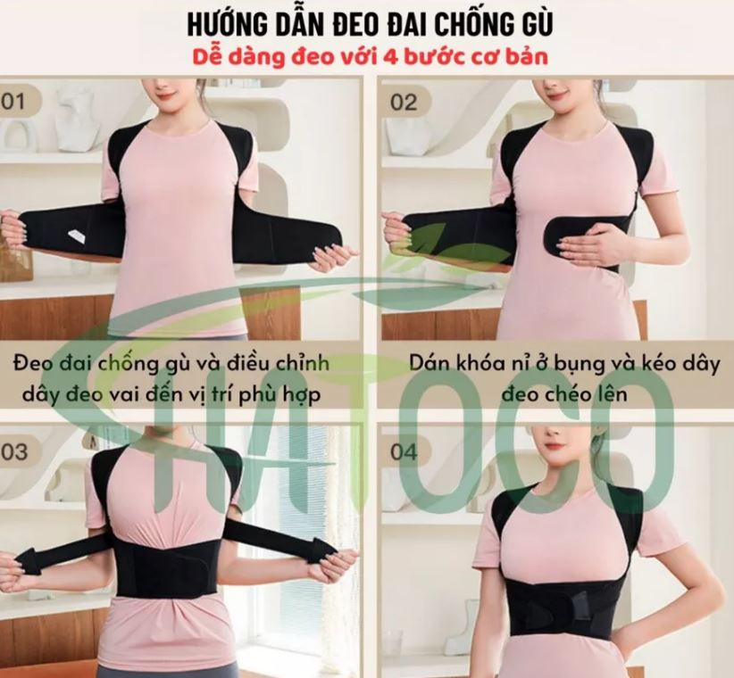 Đai chống gù lưng có tác dụng gì? Mua loại nào tốt?