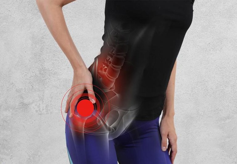 Triệu chứng đau thần kinh tọa như thế nào?