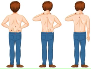 Các vị trí đau lưng nguy hiểm mà bạn nên biết ngay!