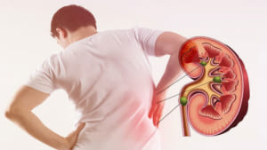 Đứng lâu bị đau thắt lưng là dấu hiệu bệnh gì? Cách điều trị?