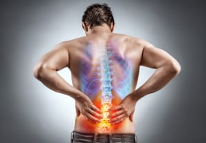 Giãn dây chằng lưng bao lâu thì khỏi? Nên điều trị thế nào?