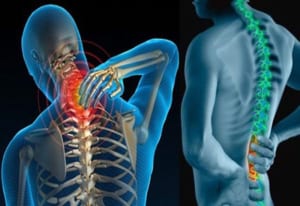 Hẹp ống sống thắt lưng có chữa được không?