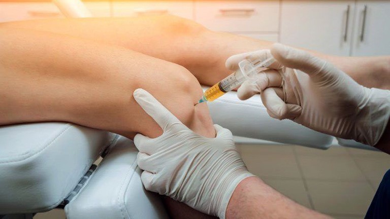 Các phương pháp điều trị thoái hóa khớp gối hiệu quả hiện nay