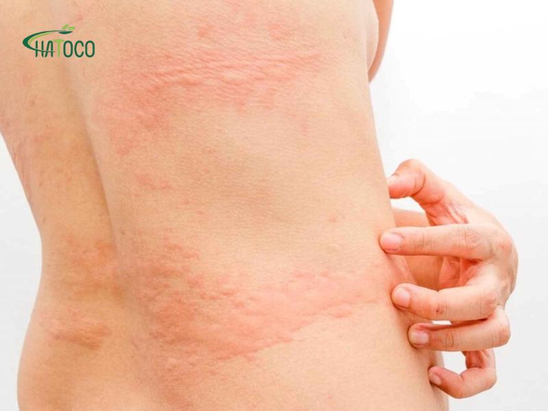 su-dung-may-massage-bung-bi-ngua-1
