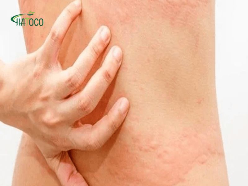 su-dung-may-massage-bung-bi-ngua-3