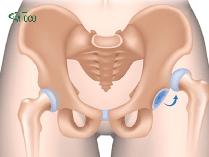 cang-co-hang-phai-lam-sao-3