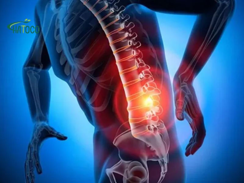 hien-tuong-cang-co-2