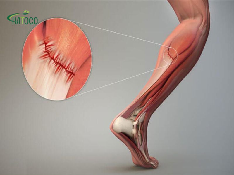 meo-chua-cang-co-bap-chan-1